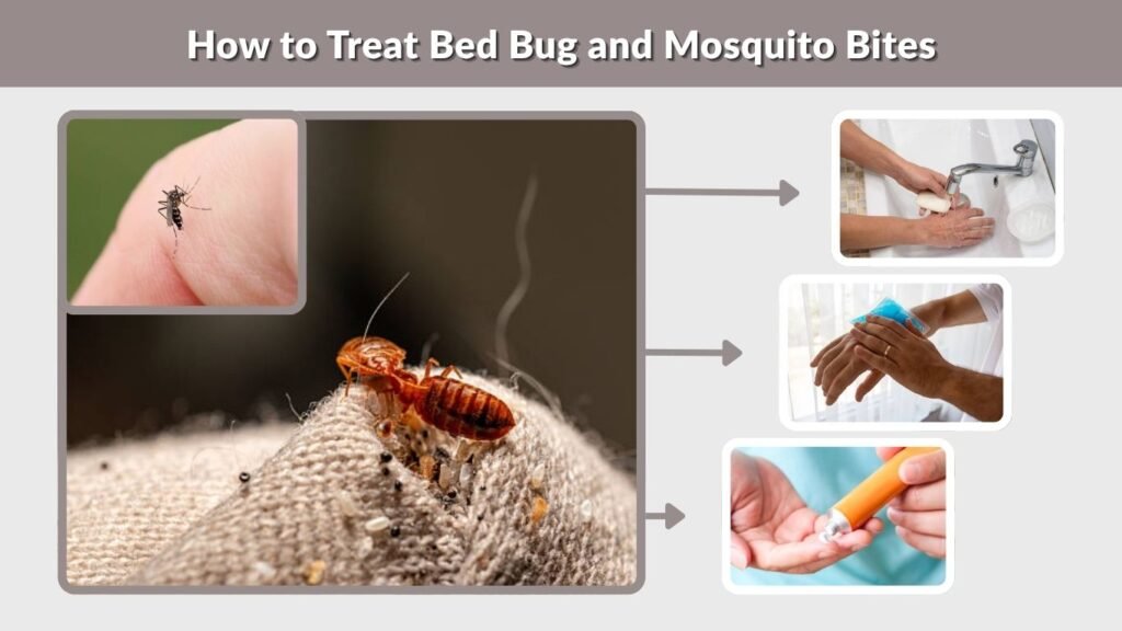 How to Treat Bed Bug and Mosquito Bites