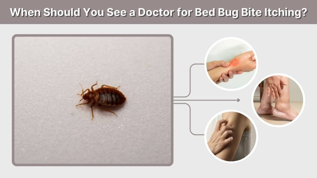 When Should You See a Doctor for Bed Bug Bite Itching?