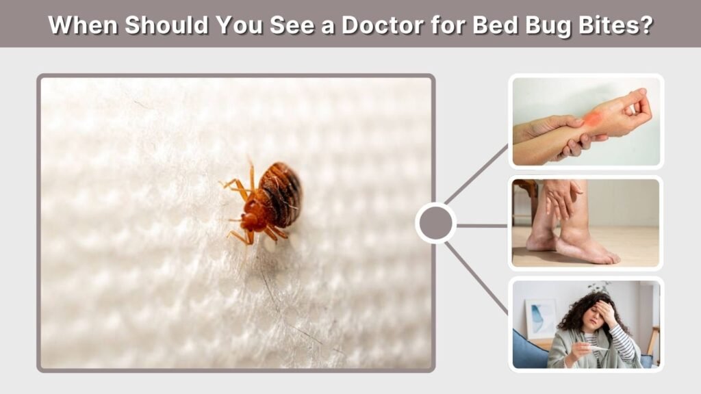 When Should You See a Doctor for Bed Bug Bites?