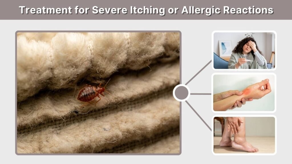 Treatment for Severe Itching or Allergic Reactions
