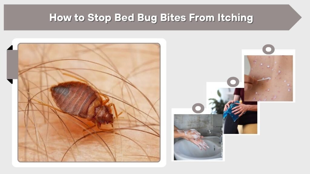 How to Stop Bed Bug Bites From Itching