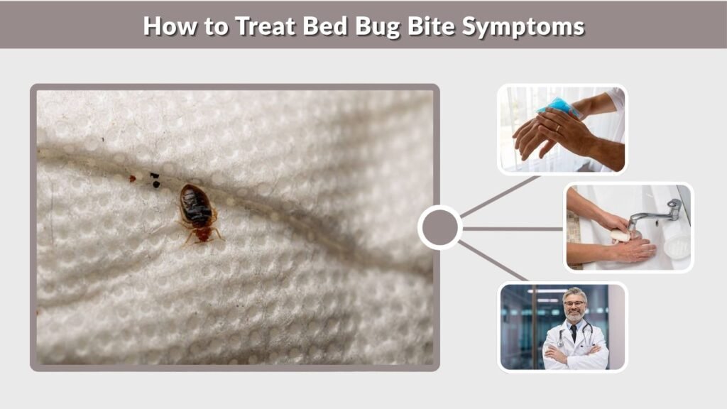 How to Treat Bed Bug Bite Symptoms