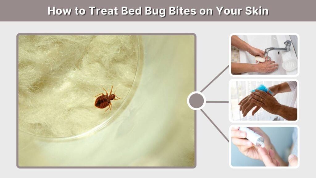 How to Treat Bed Bug Bites on Your Skin