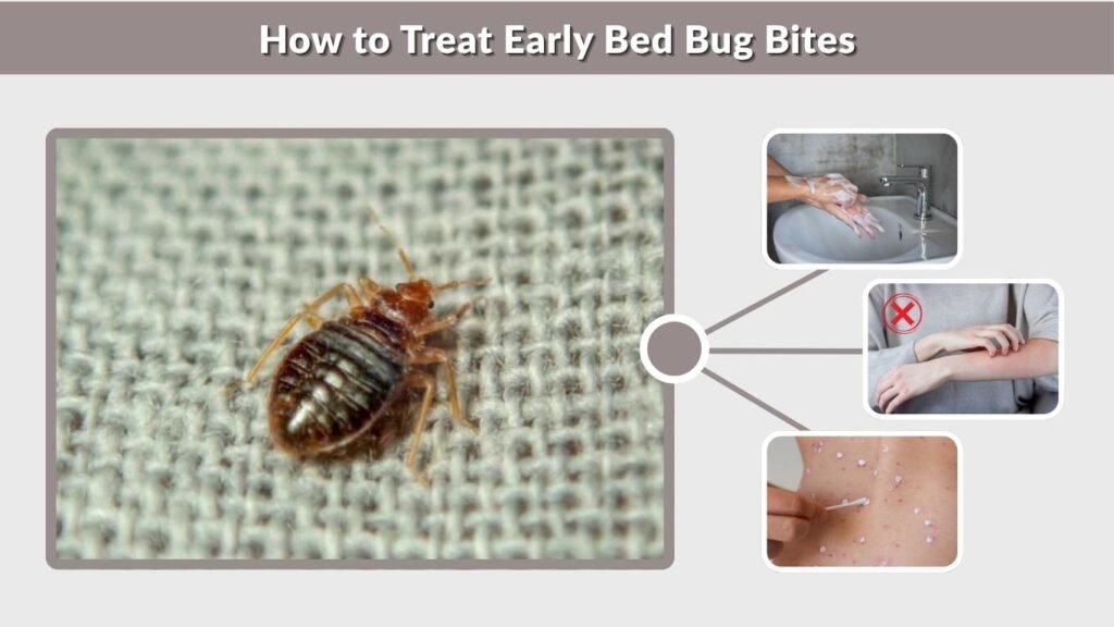 How to Treat Early Bed Bug Bites